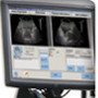 Tomotherapy